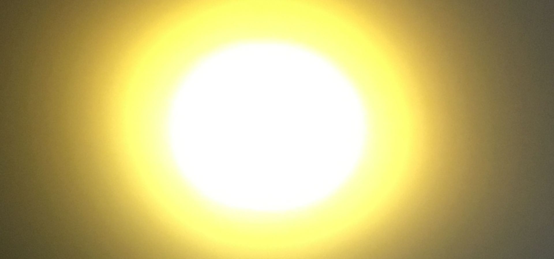 Endovenöse Laserbehandlung 